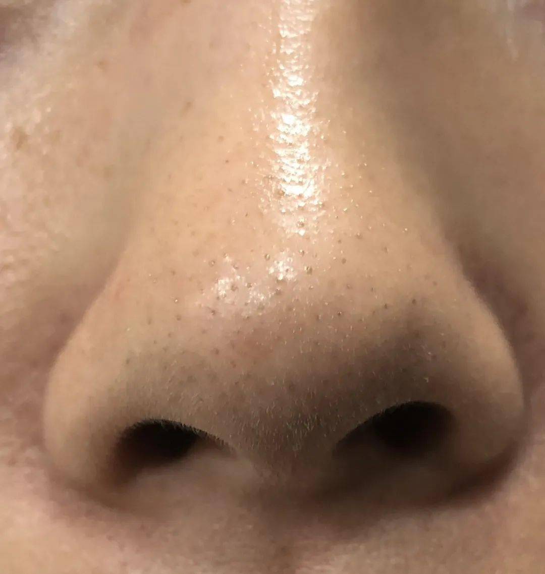 角质|能搓出“脏东西”的它3秒卖出一瓶！去角质、黑头、收毛孔，给你肌肤来次“大扫除”!