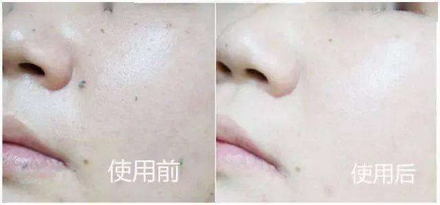 角质|能搓出“脏东西”的它3秒卖出一瓶！去角质、黑头、收毛孔，给你肌肤来次“大扫除”!