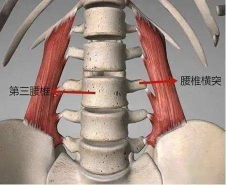 腰椎横突综合症的发生及临床特点,与局部的骨骼,肌肉及神经的解剖特点
