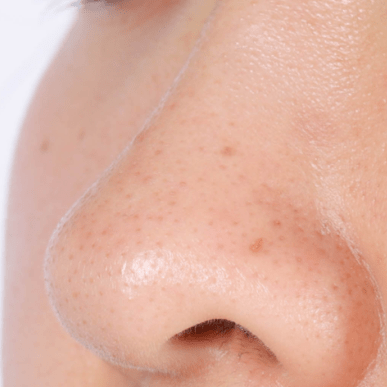 皮肤|纯分享：我最爱的11款小众面膜都在这了！