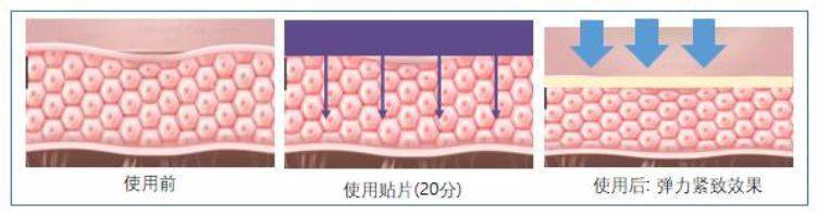 效果|这个比瘦脸针还好用的好物，既消水肿又提拉紧致，立变小V脸！