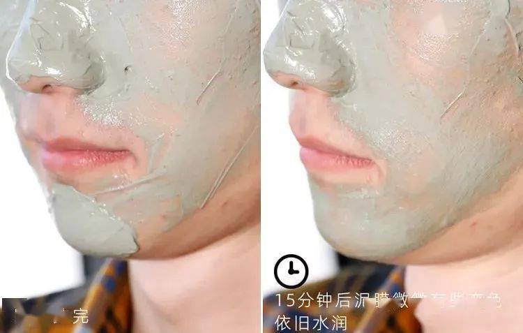 吸铁石|新西兰百年历史“污垢吸铁石”,15分钟告别黑头、粉刺、闭口!