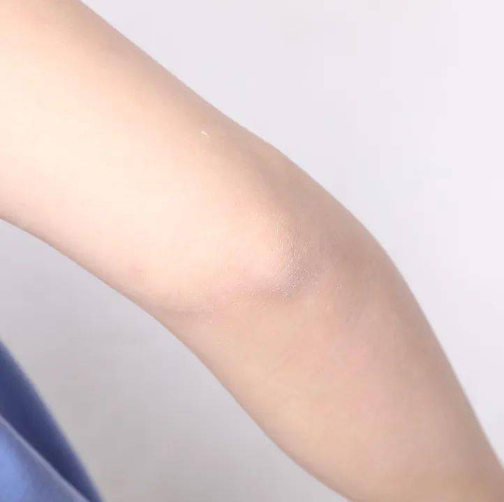 肤色|脖子比脸黑太多？夏日的宝藏救星，没想到竟是它！