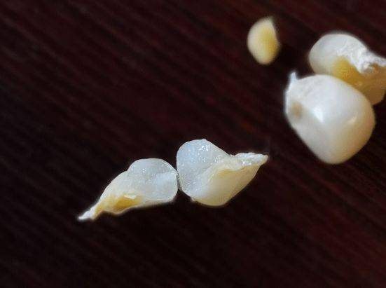 解药|解药很甜思念很玄