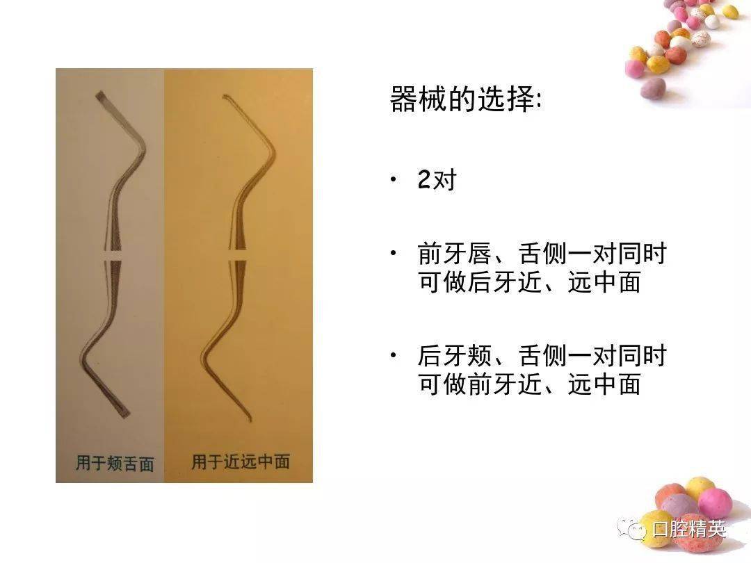 龈下刮治术