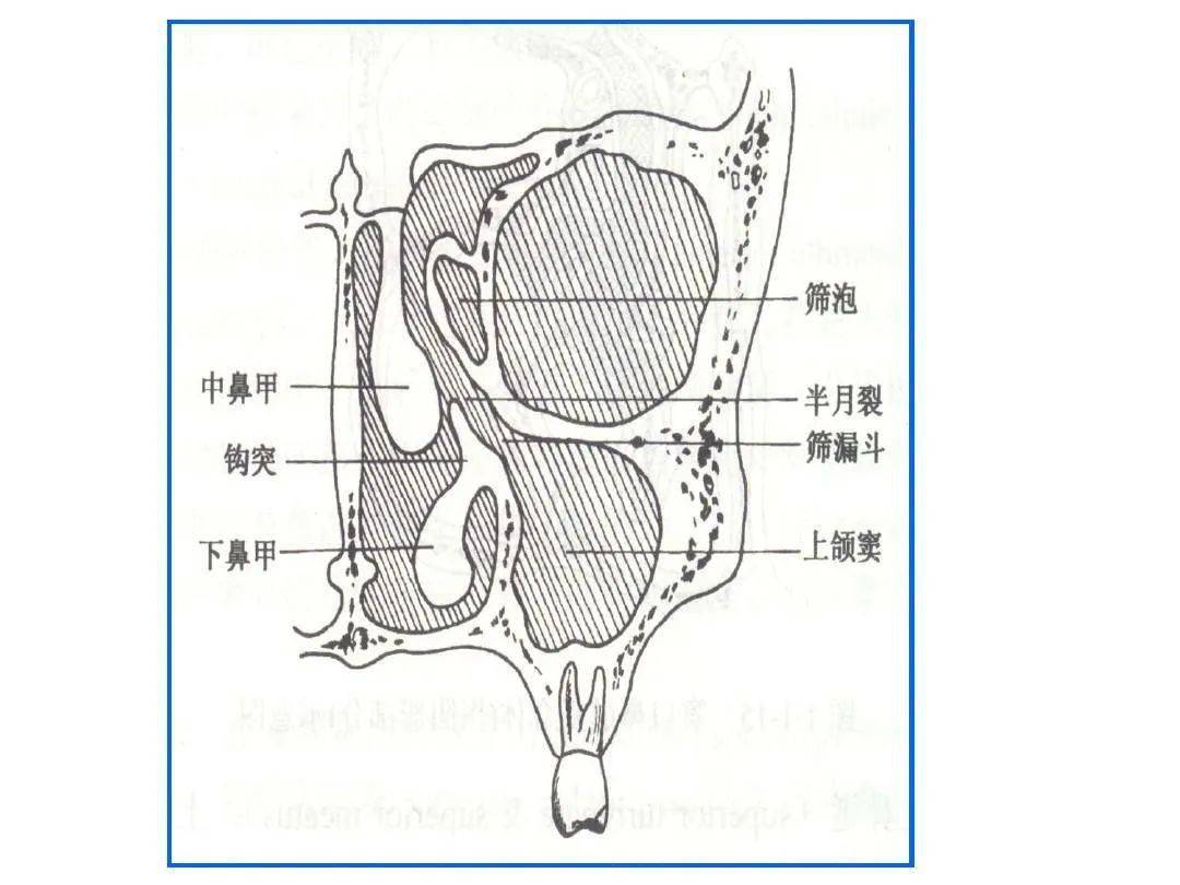 鼻的影像解剖