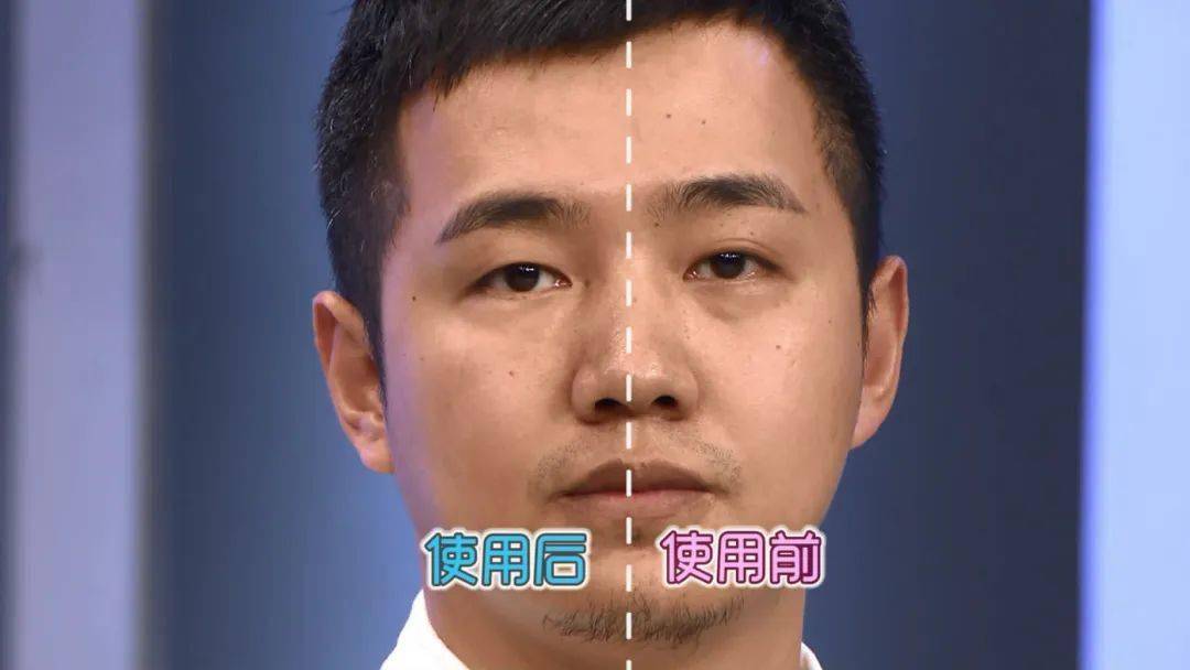 效果|震撼黑科技！搞定眼袋、细纹、浮肿、黑眼圈……效果比PS还好！