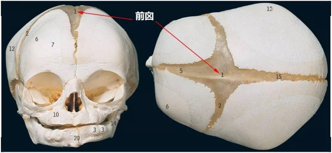 颧弓:相当于颞叶下缘枕后点opisthocranion:是枕骨最突向后方的点.