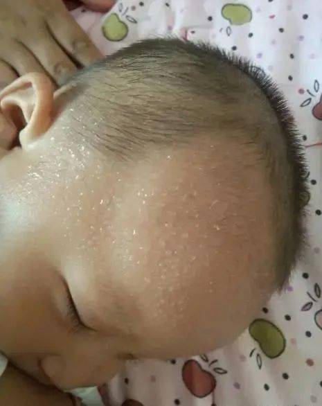 缺钙|宝宝睡觉不踏实,你以为他是缺钙了?不,可能是这些原因!