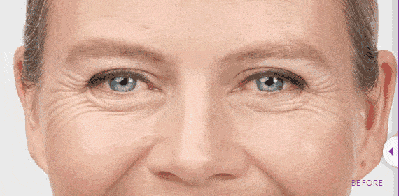 肌肤|皮肤油腻的元凶竟是它！补水保湿，99%的人用错了！