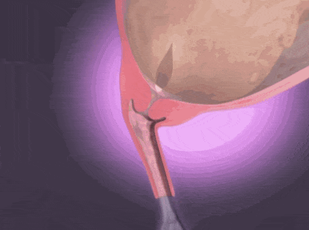 3d图解孩子是怎么生出来的?安全分娩从产前评估做起!