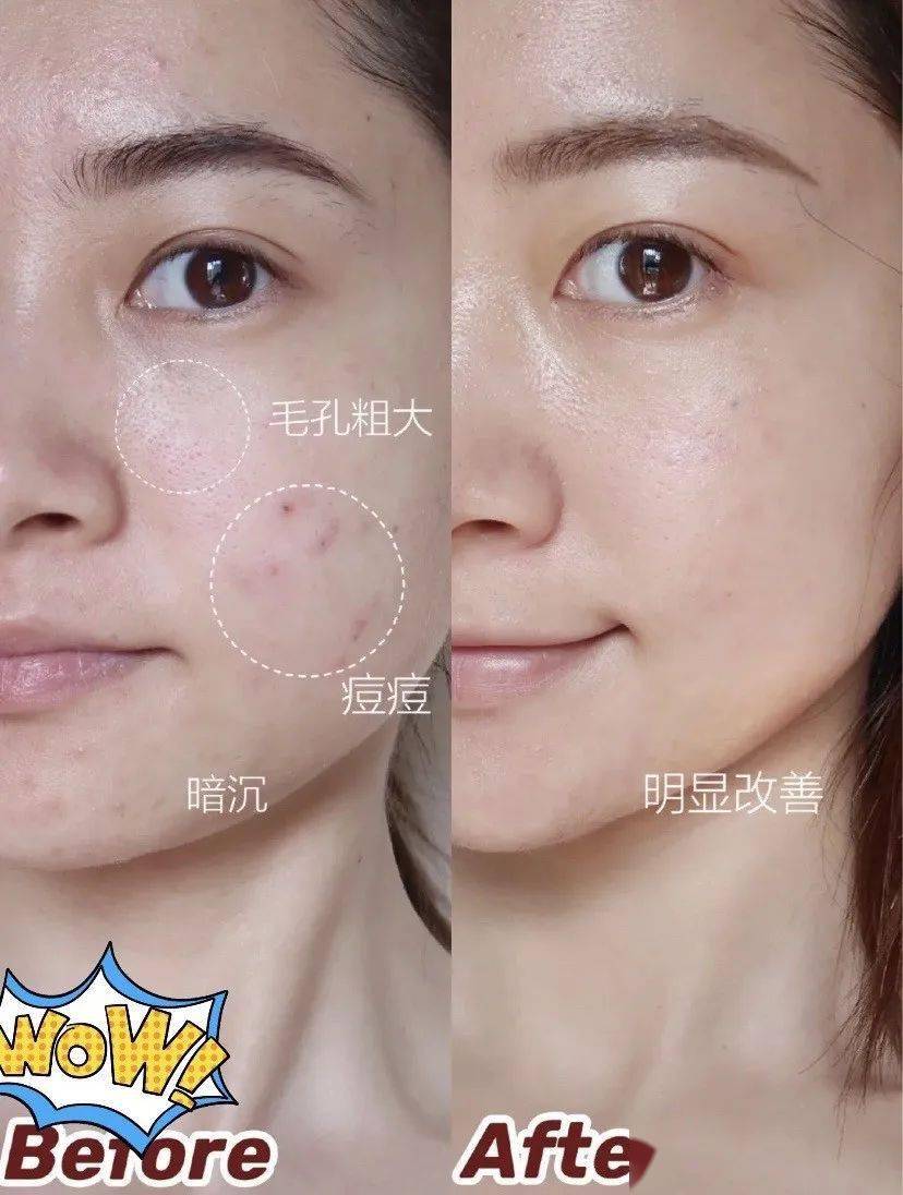 兰蔻平|测评|兰蔻平替的欧莱雅精华,真的夸腻了!