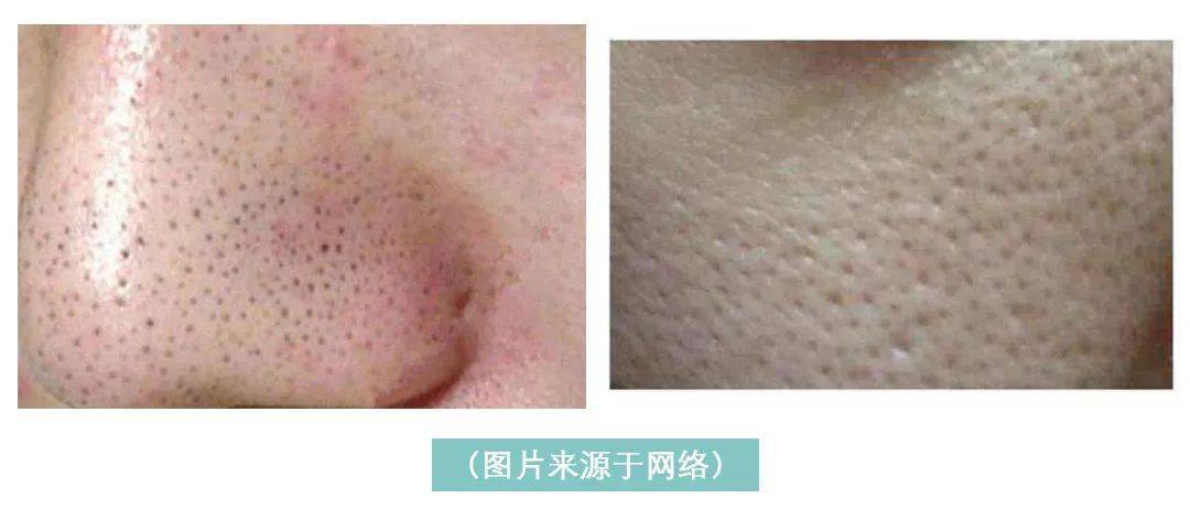 同事|三十而已,凭啥被00后同事比下去了?