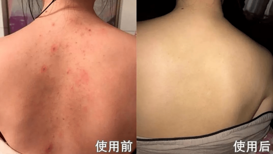 角质|薇娅吹爆的这款磨砂膏,我替你们试了,用完蚊子能在背上劈叉!