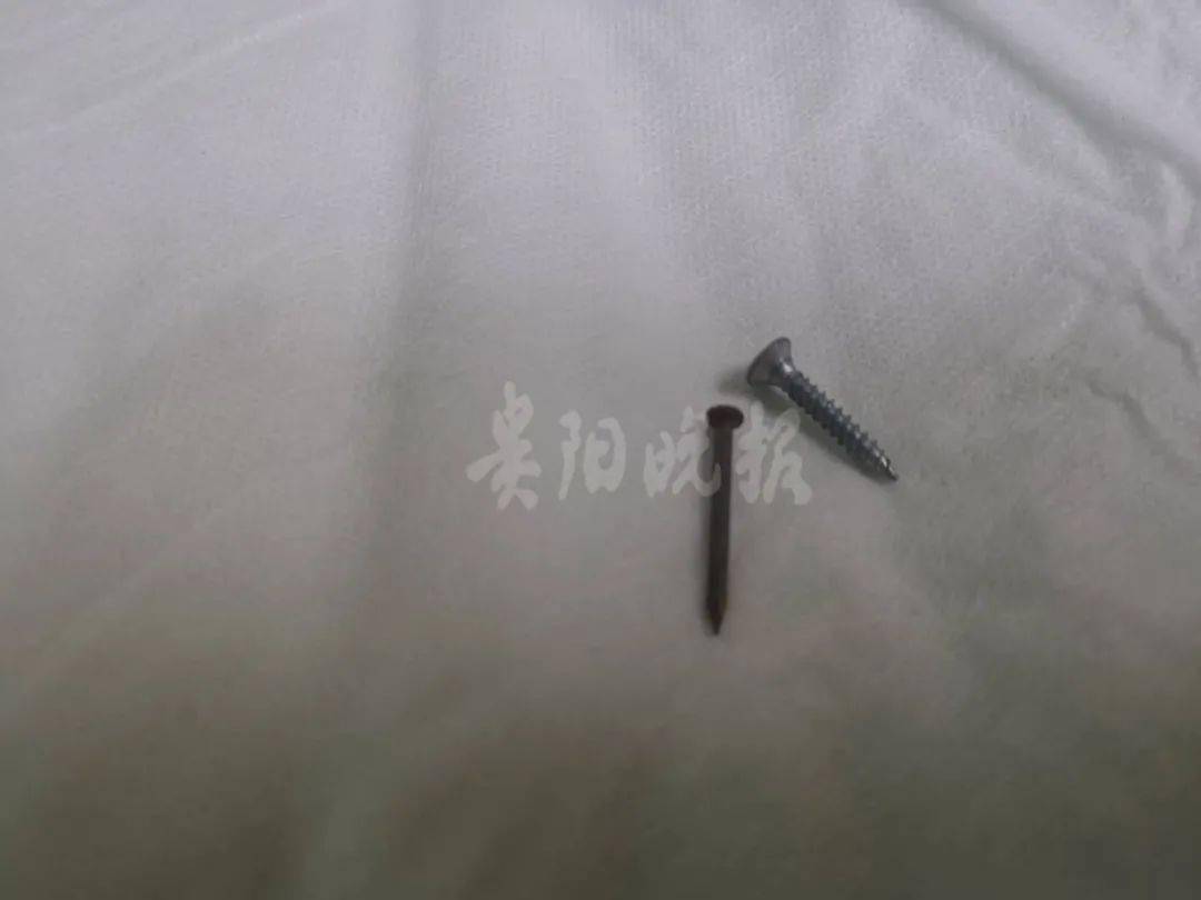 硬币|医生都无语！孩子竟吞下这些怪东西！硬币、指甲刀、电池、钉子……