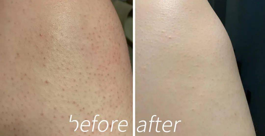 角质|薇娅吹爆的这款磨砂膏,我替你们试了,用完蚊子能在背上劈叉!