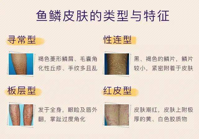 皮肤|想知道如何让肌肤常驻18岁吗？想知道明星三四十岁依然拥有靓丽肌肤吗？点进来我告诉你