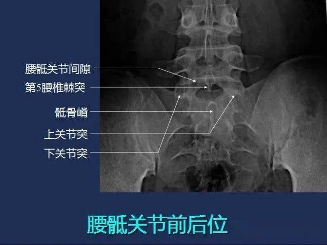 影像解剖 | 全身常规x线,骨关节mri断层解剖大全