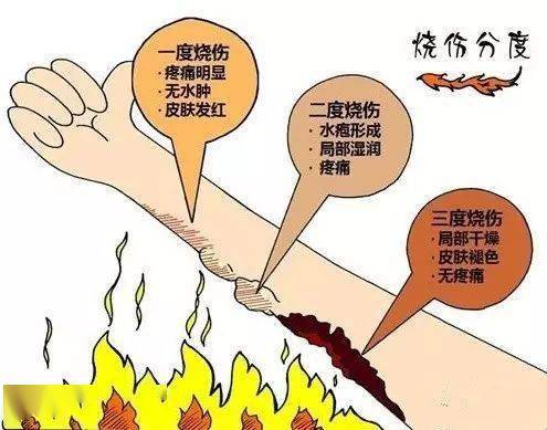 孩子|家属这样处理,差点让小孩送命......心疼~福建6月大女婴被开水烫伤