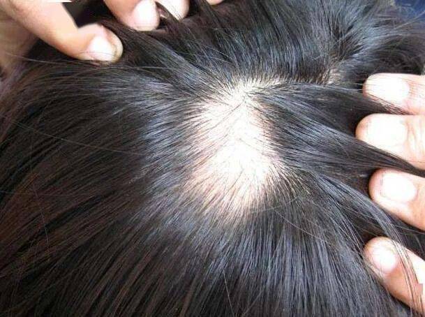 脱妆就上热搜?其实他这里也“脱”了 脱妆就上热搜?其实他这里也“脱”了
