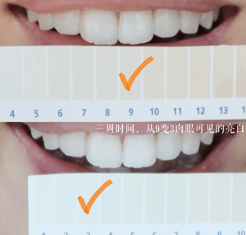 牙膏|牙黄真的太毁颜值！连涂口红都没人家好看