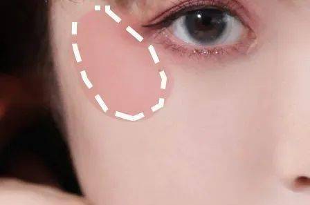 眼睑|手把手教学