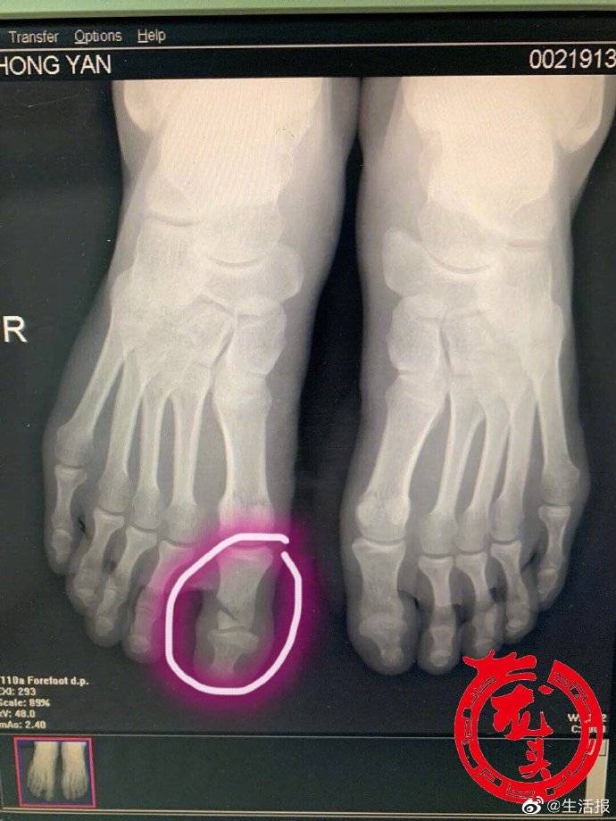 耿硕|嫌家中板凳不平 男子拿起电锯，脚下一滑悲剧了