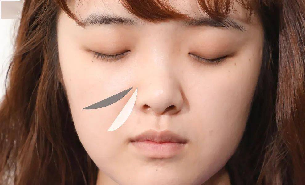 眼睑|手把手教学