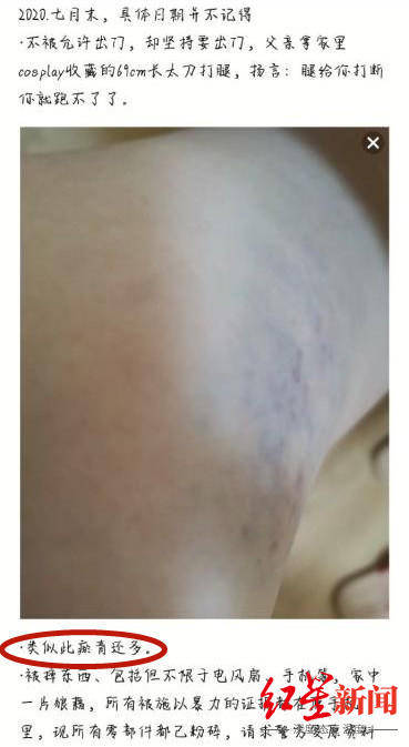 微博|南充少女遭家暴？邻居眼里很优秀，沉迷手机曾看心理医生，官方调查未发现有家暴