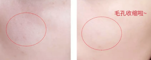 换季|吴昕、林允睡前都在用的懒人超爱保养品，一次性解决换季皮肤敏感、泛红、脱皮...