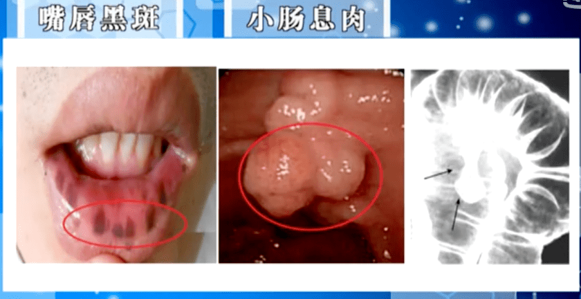 医生|就因为医生多看了一眼，救了一命！这些信号你都要知道！