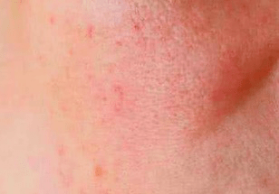 级别|几十块能搞到什么换脸级别的护肤品？