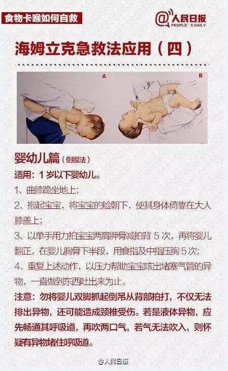 孩子|医院上演“生死时速”！关键时候，学会这招能保命！2岁半男童吃花生遇险