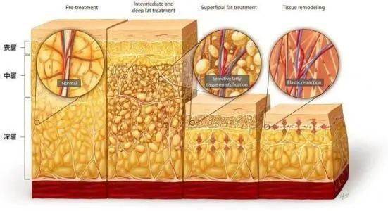 Notice|甩掉32斤，自律让我遇见最好的自己