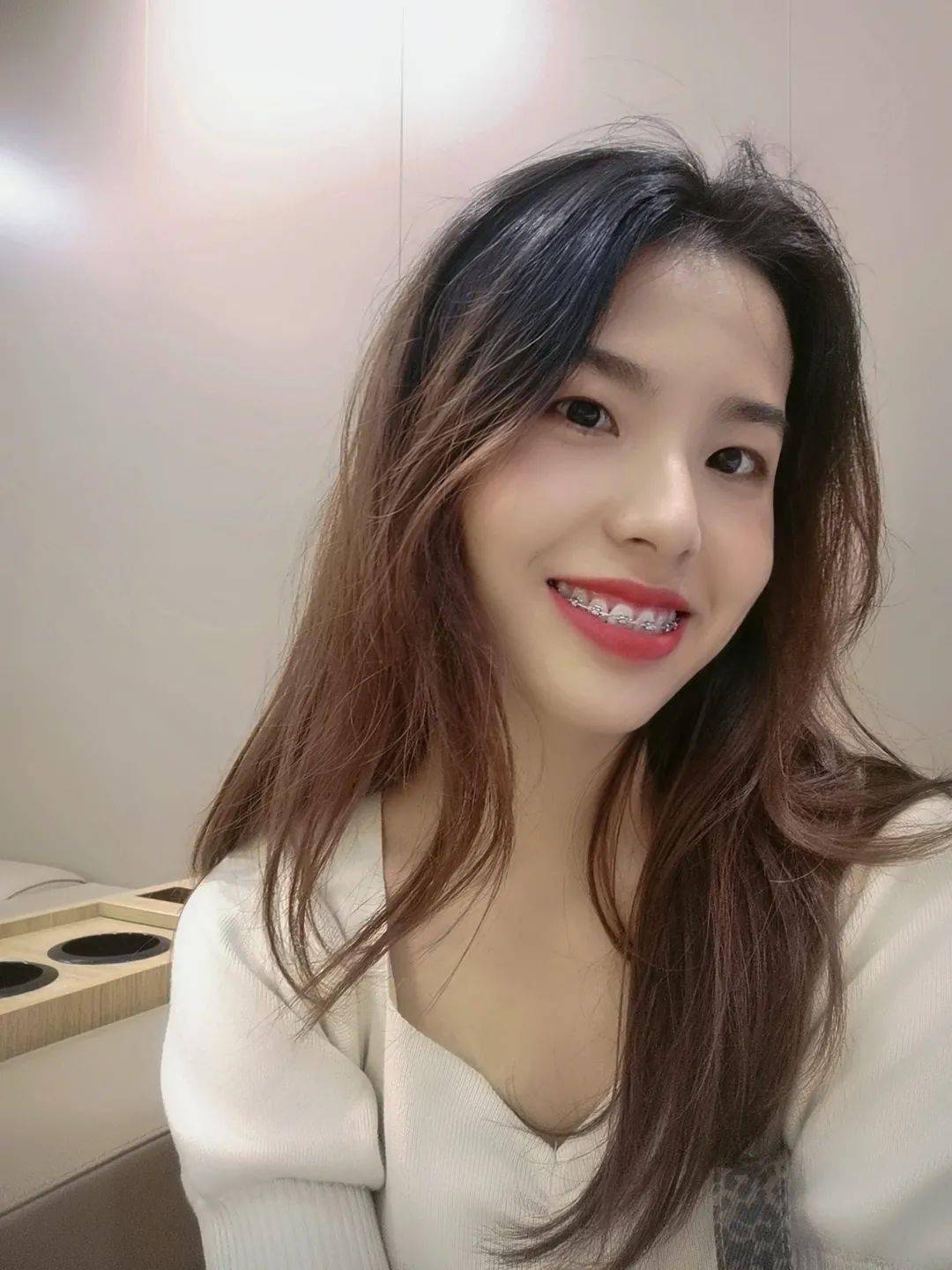 龅牙|广州95后女生从小龅牙，嘴巴都快闭不上！朋友却劝她不要矫牙，一年后......