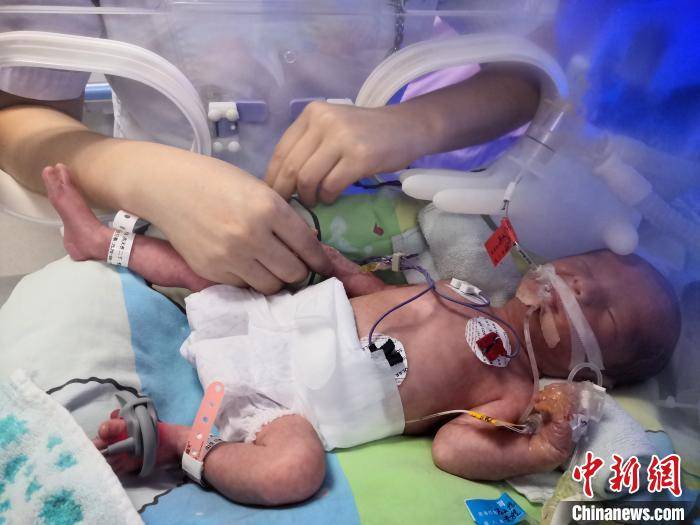 自然|湖北宜昌产妇诞下罕见龙凤四胞胎