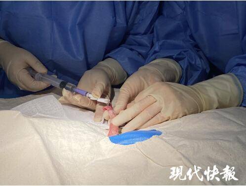 无锡|出生仅一瓶矿泉水重！无锡530克早产宝宝救治成功