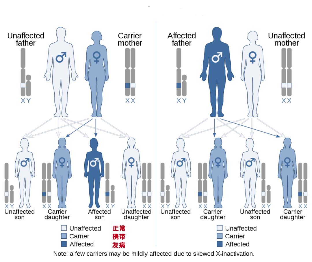 遗传特性决定了,本病男性患 