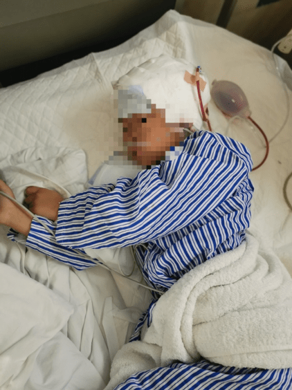 手术|6岁女孩全身抽搐2个多小时，脑中竟长“拳头大”恶性肿瘤