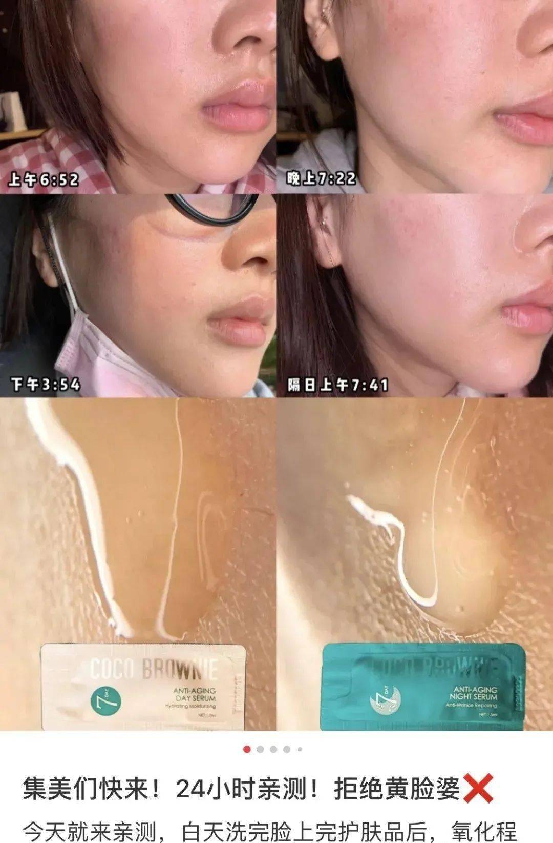 肌肤|40岁的年龄，18岁的脸，深扒“金喜善们”的冻龄术，竟然都是它！