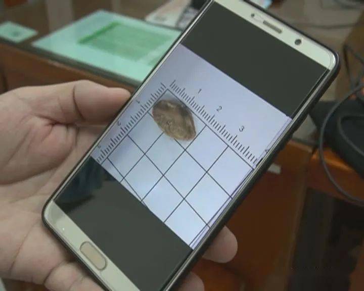 南瓜子|孩子的这些动作一定要制止！7岁女童气管内竟“长出”2厘米南瓜子