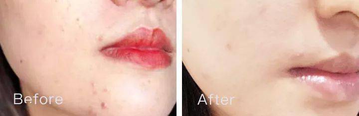 脸蛋|你的脸蛋“一键美颜”,除了滤镜还靠什么?