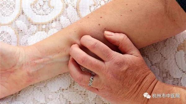 身上瘙痒是什么病症引起的 7545b98aaf5545c1a63eafab3bf4c1ca.jpeg