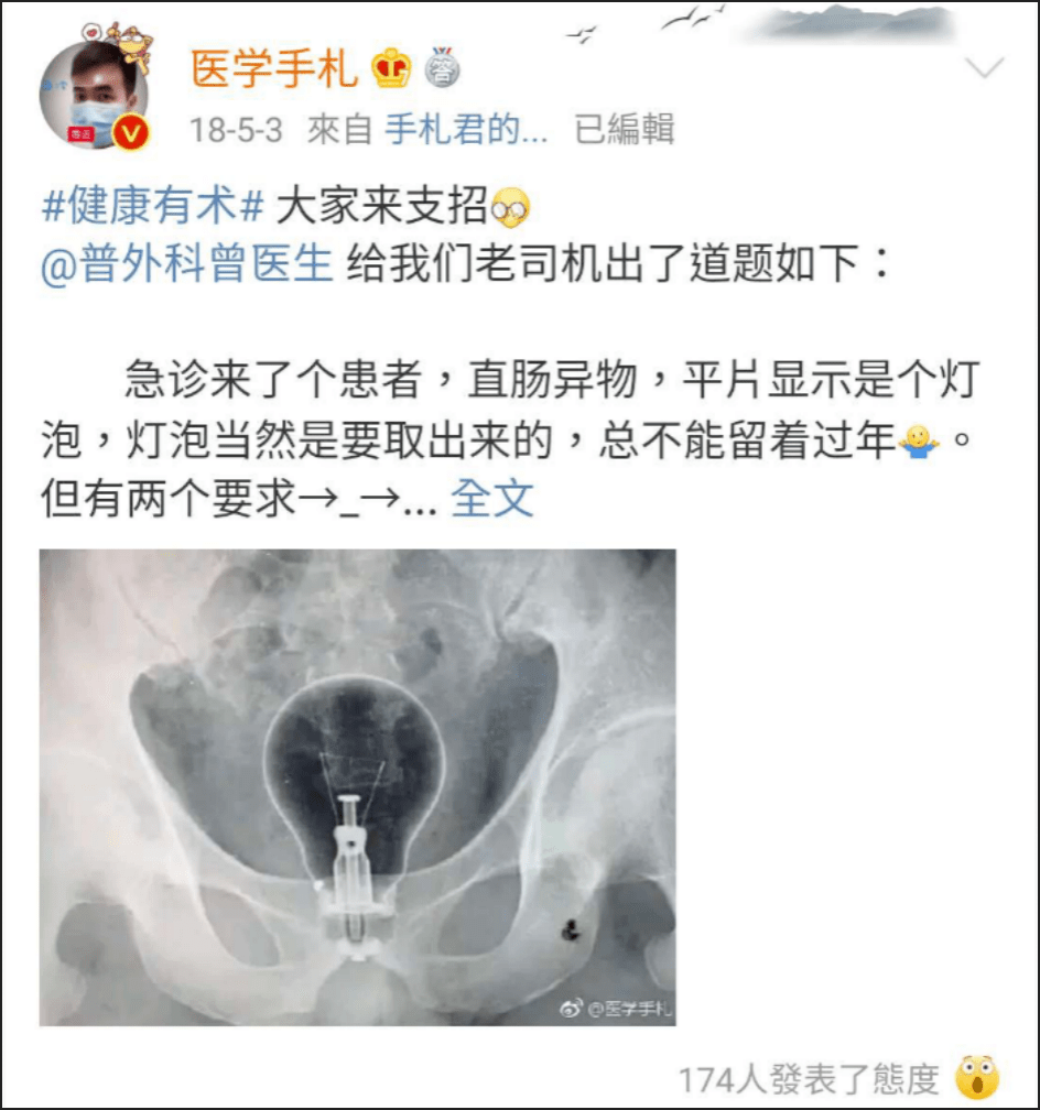 肛门|医生在直肠里找到了啤酒杯、罗非鱼、茄子、灯泡、泥鳅.....