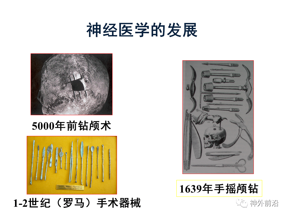 神经|智慧神外 | 天坛医院赵元立：大数据时代的神经医学发展