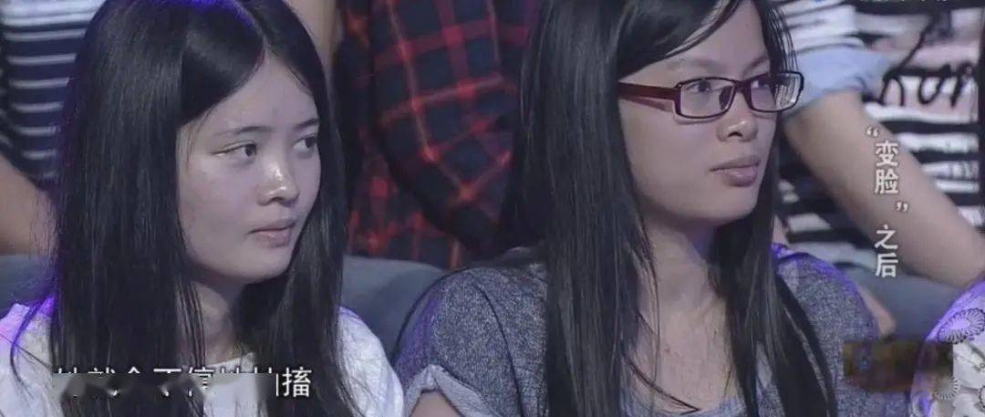 畸形|“我花100万，把女儿整成了残废”：畸形审美毒害下，有20万女孩正在消失！