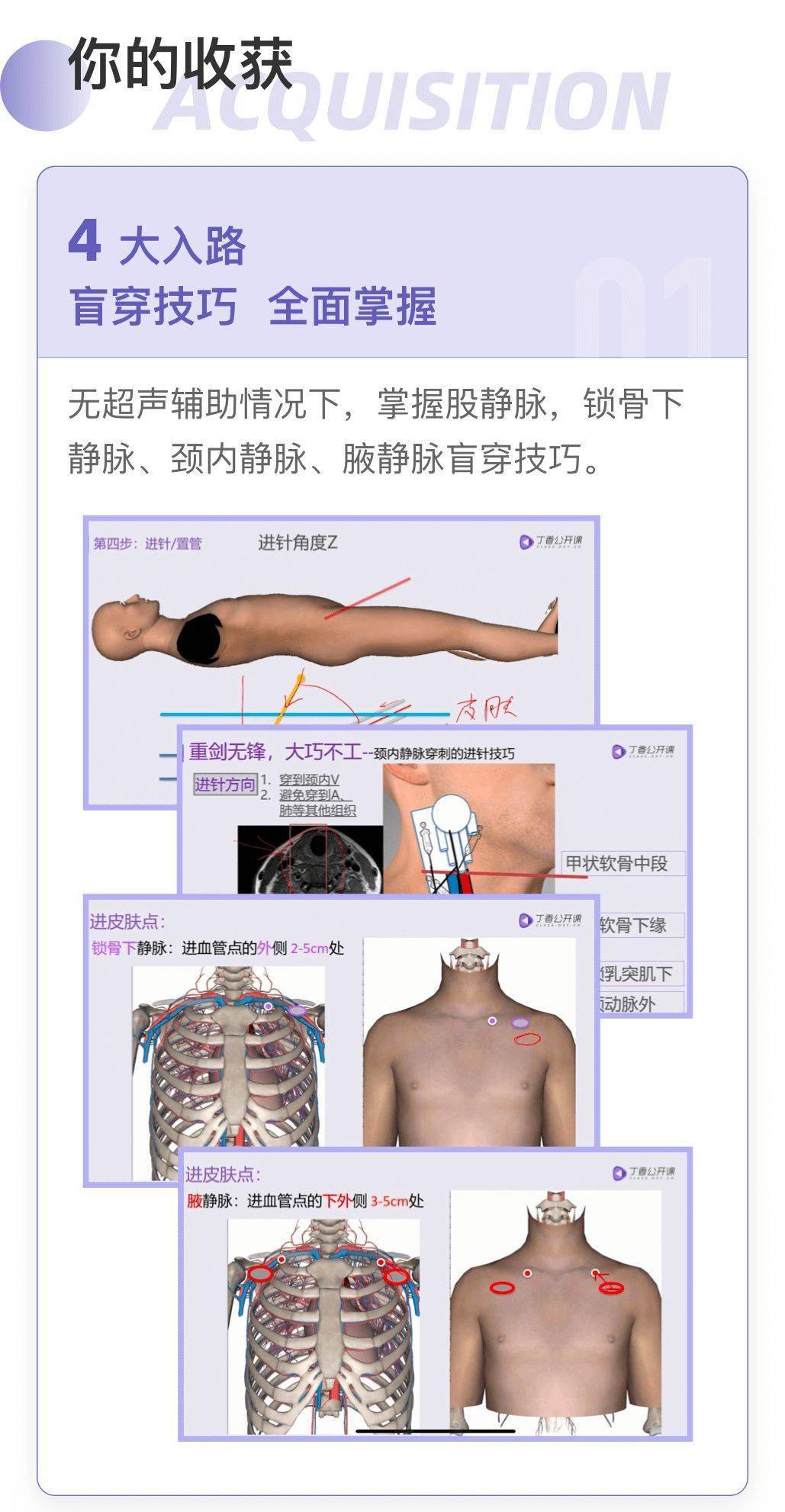 导丝|深静脉穿刺置管困难，你可能栽在这个细节！