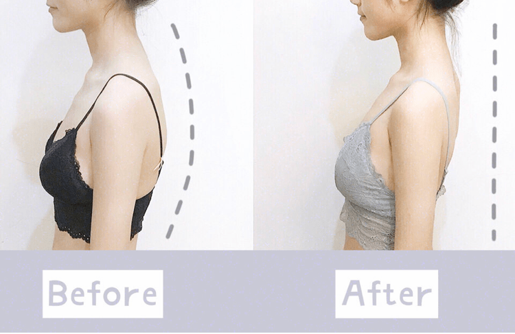 智商|张雨绮的矫姿带到底是智商税，还是真女神制造机？