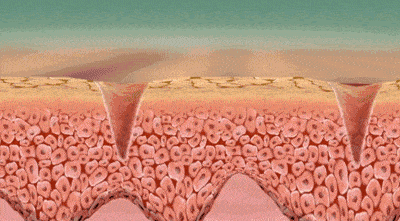 贫民窟|杨幂熬夜后护肤要花2万块？怪不得皮肤吹弹可破！贫民窟女孩就不配消除熬夜痘、黑眼圈吗？