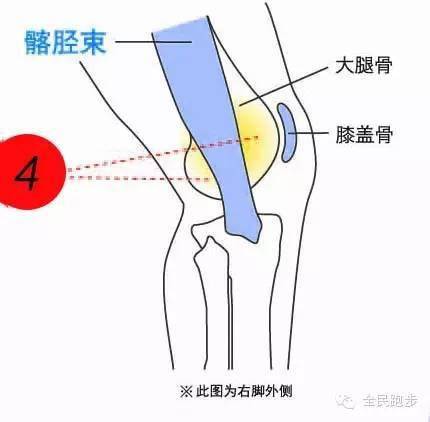 胫骨结节骨软骨病 (标题序号与图中序号相对应) 常见于正在成长期的